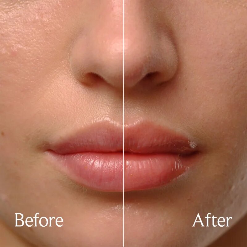 fresh Sugar Treat Lip Oil olje za ustnice omejena izdaja odtenek Honey 4 ml