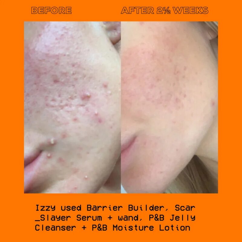 Glow Hub The Scar Slayer serum za osvetljevanje proti pigmentnim madežem 30 ml