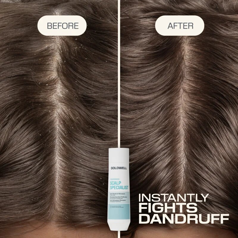 Goldwell Dualsenses Scalp Specialist Anti-Dandruff Shampoo šampon proti prhljaju 250 ml