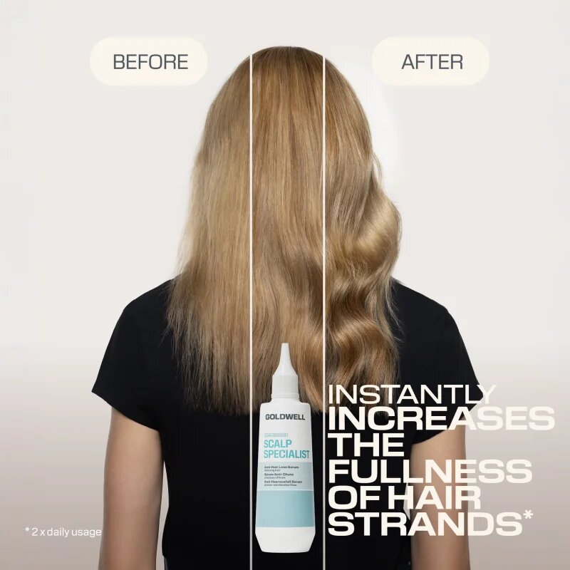 Goldwell Dualsenses Scalp Specialist Anti-Hair Loss Serum serum proti izpadanju las 150 ml