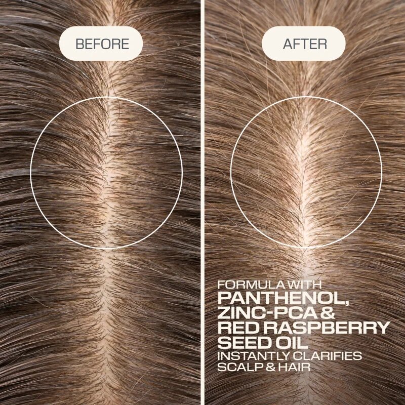 Goldwell Dualsenses Scalp Specialist Clarifying Shampoo globinsko čistilni šampon 1000 ml