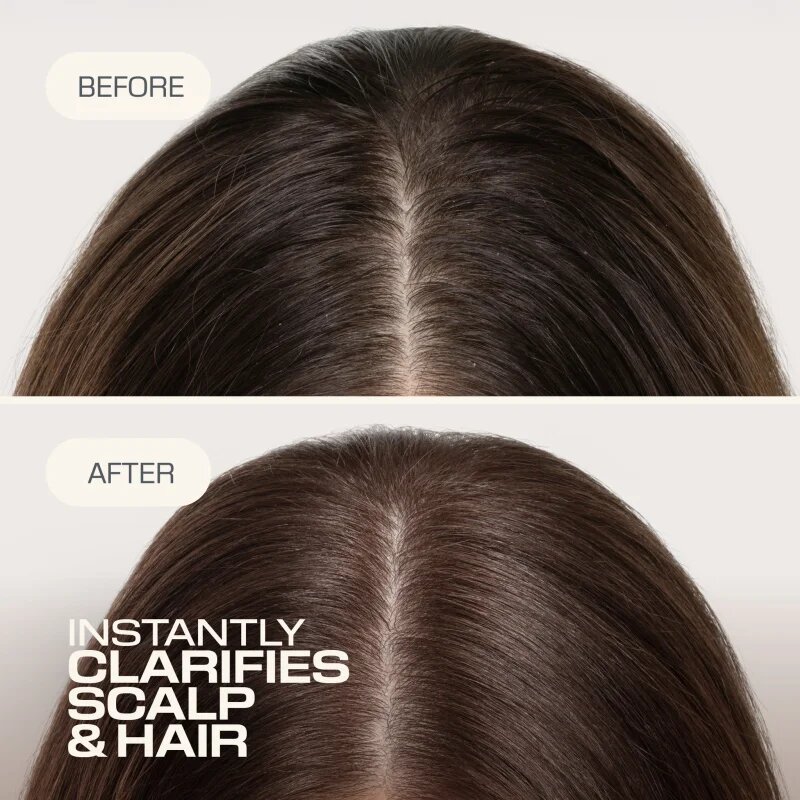 Goldwell Dualsenses Scalp Specialist Clarifying Shampoo globinsko čistilni šampon 250 ml