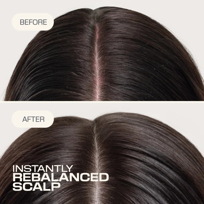 Goldwell Dualsenses Scalp Specialist Rebalance & Hydrate Fluid vlažilni fluid za obnovo lasišča 150 ml