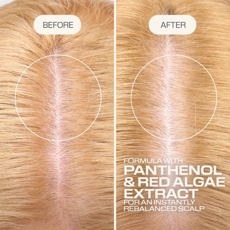 Goldwell Dualsenses Scalp Specialist Rebalance & Hydrate Fluid vlažilni fluid za obnovo lasišča 150 ml
