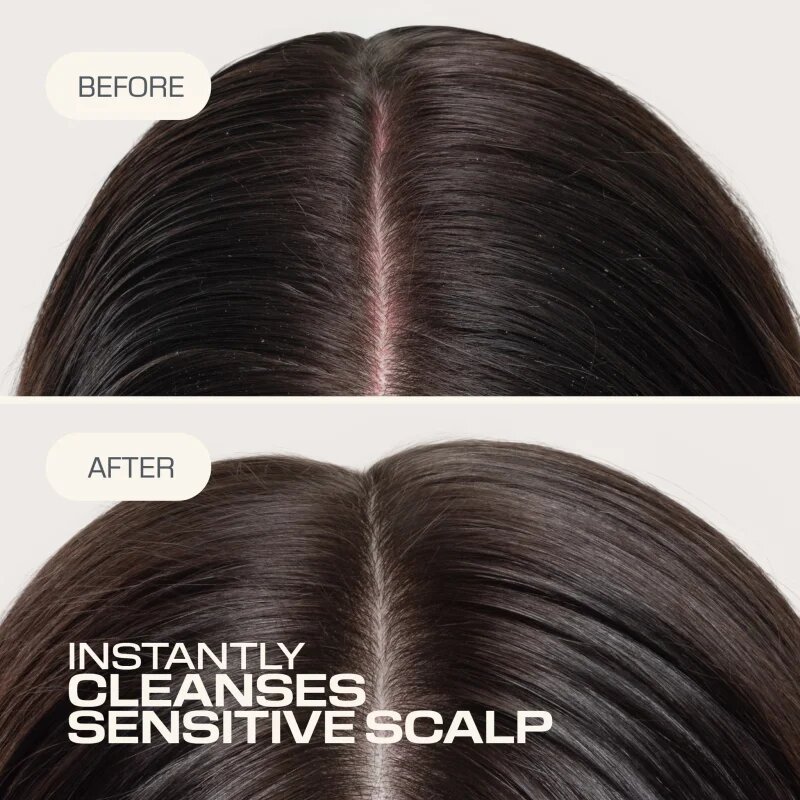 Goldwell Dualsenses Scalp Specialist Sensitive Foam Shampoo penast šampon za občutljivo lasišče 250 ml