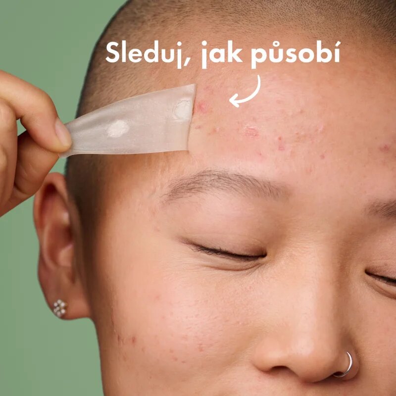 Hero Cosmetics Mighty Patch XL obliži za problematično kožo 10 kos