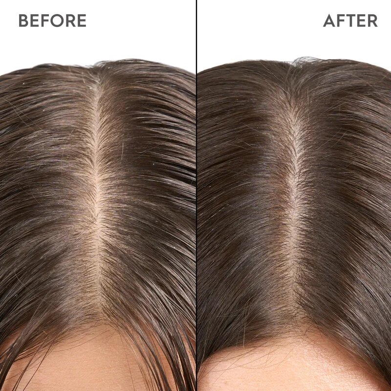 KERASILK Specialists Exfoliating Scalp & Hair Treatment nega pred šamponiranjem z učinkom eksfoliacije 200 ml