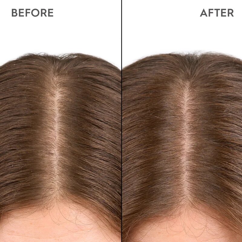 KERASILK Specialists Moisturizing Scalp Drops kapljice za suho in občutljivo lasišče 100 ml