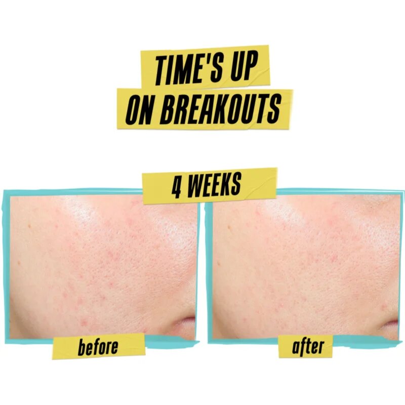 Kiehl's Dermatologist Solutions Expertly Clear Blemish-Treating & Preventing Lotion krema za obraz za aknasto kožo za ženske 60 ml