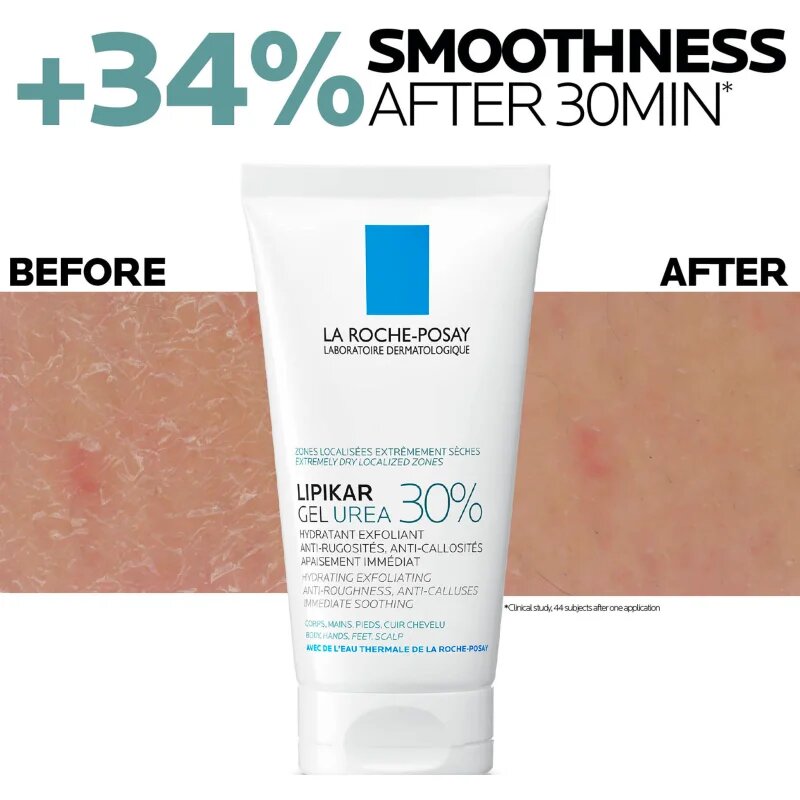 La Roche-Posay Lipikar Gel Urea 30% globinsko vlažilni gel za trdo kožo 50 ml
