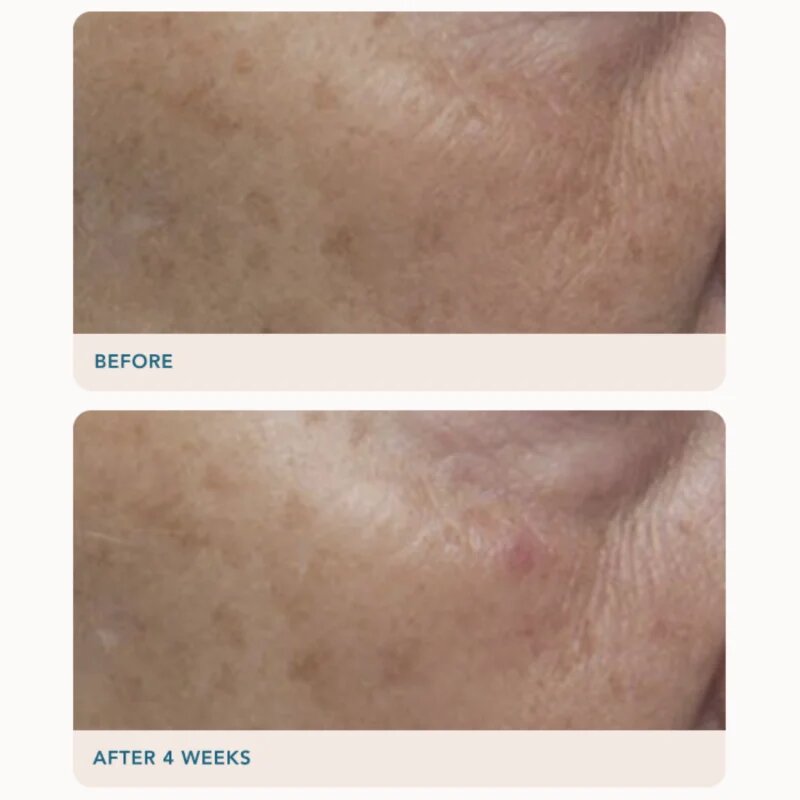 LANCER GRAVITY DARK SPOT CORRECTING SERUM serum proti temnim madežem 30 ml