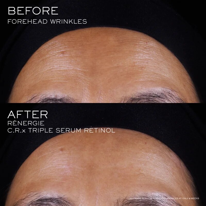 Lancôme Rénergie CRX Triple Serum Retinol serum za obraz 20 ml