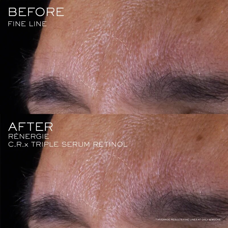 Lancôme Rénergie CRX Triple Serum Retinol serum za obraz 50 ml