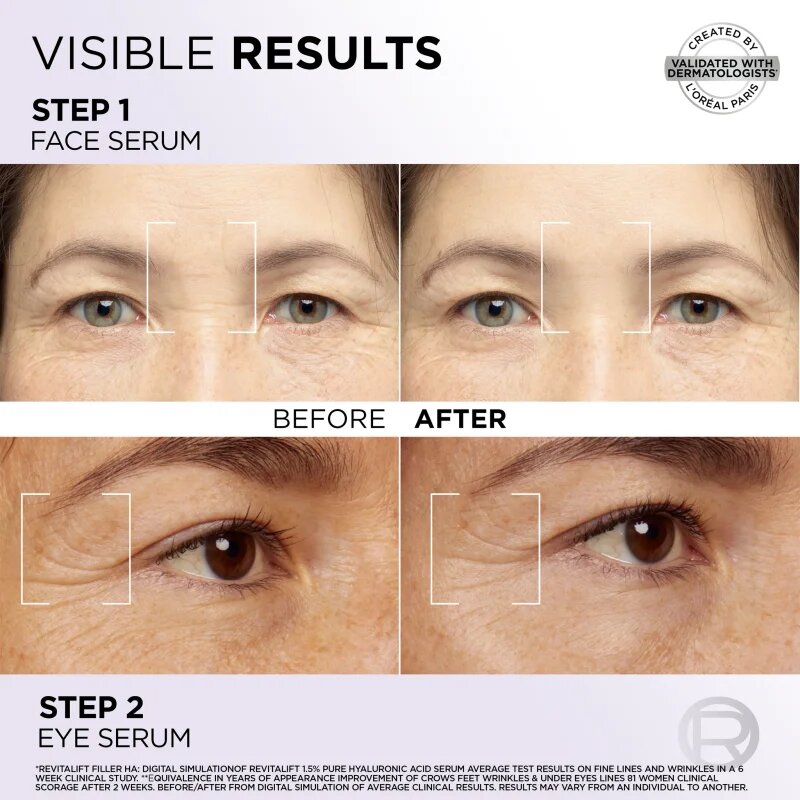 L’Oréal Paris Revitalift Filler set za nego obraza za obraz in predel okoli oči