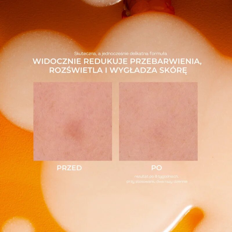 Lumene Nordic-C [VALO] Dark Spot Serum posvetlitveni serum z vitaminom C proti pigmentnim madežem 30 ml