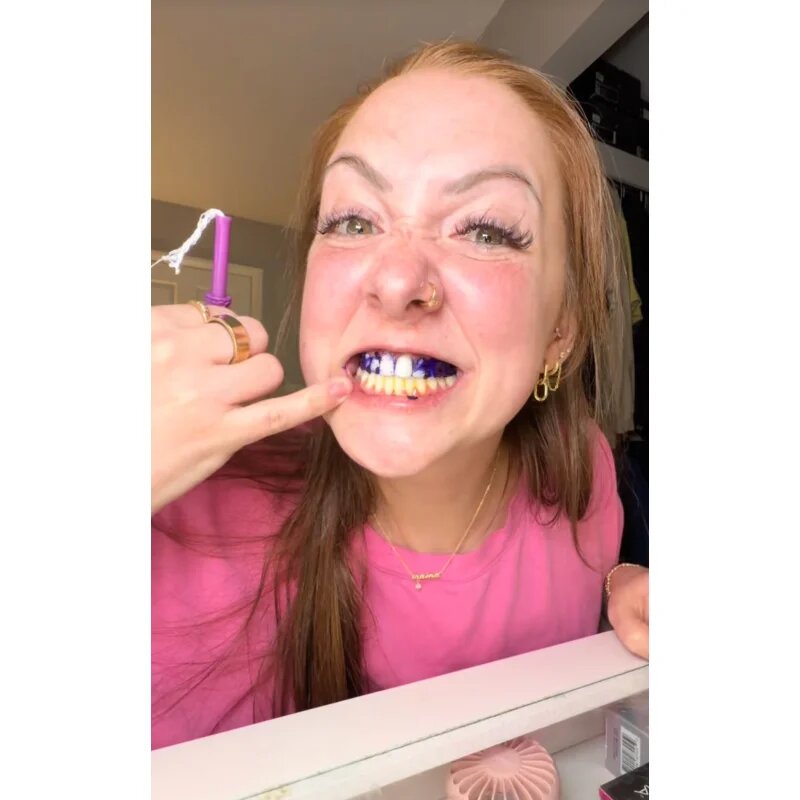 LYSS V34 belilni trakovi 1 kos