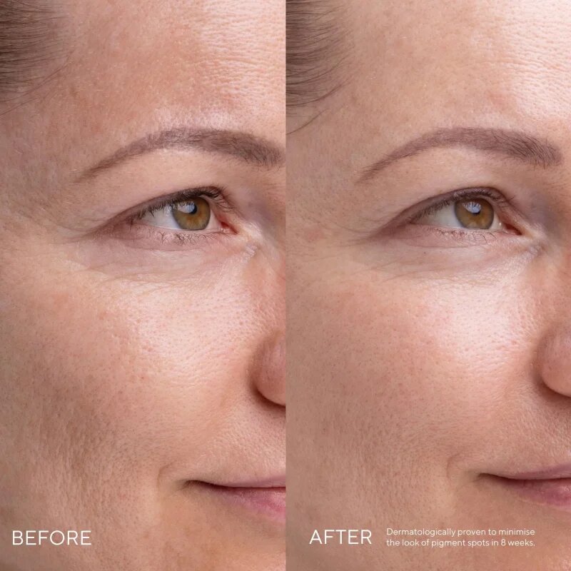 Mádara MÁDARA Kojic Alternative Pigment Serum serum proti pigmentnim madežem 30 ml