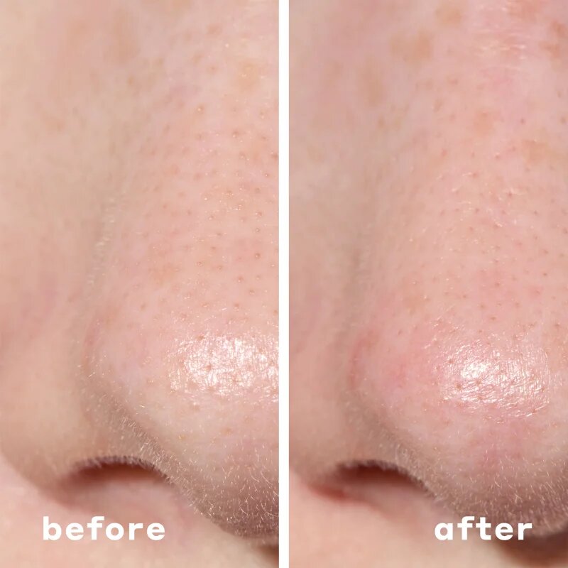 Mario Badescu 2-in-1 Deep Cleansing Pore Strip obliži za problematično kožo 2 v 1 6 kos