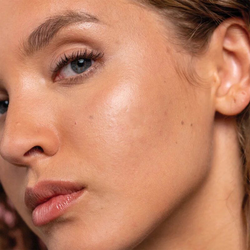 Mario Badescu Drying Patch obliži za problematično kožo 36 kos