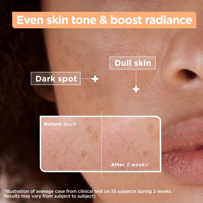 MIXA Anti-Dark Spot serum proti pigmentnim madežem 30 ml