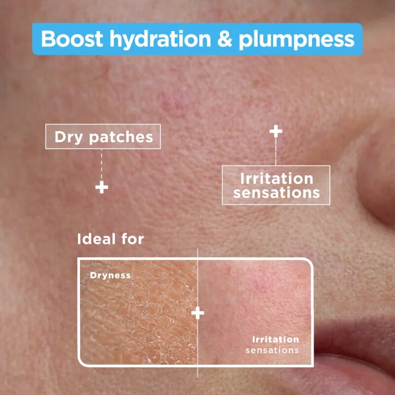 MIXA Anti-Dryness pomirjajoči vlažilni serum 30 ml