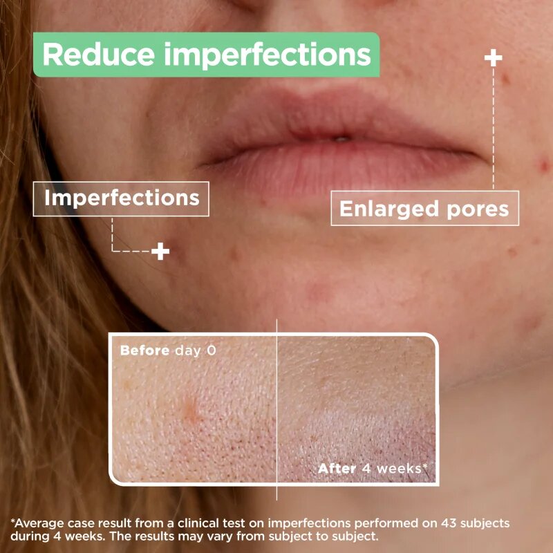 MIXA Anti-Imperfection serum za problematično kožo akne 30 ml