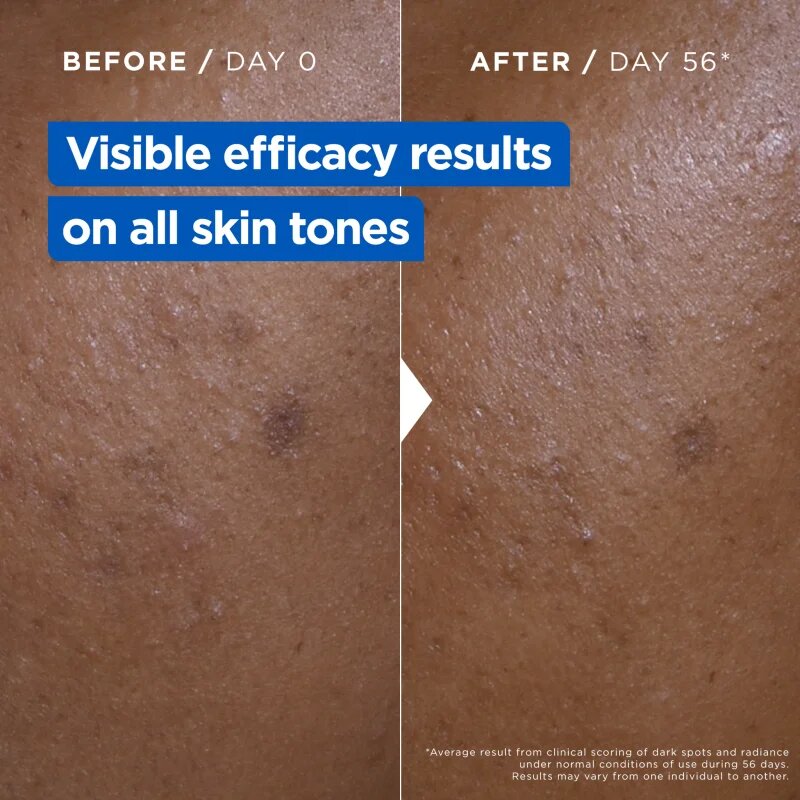 MIXA Niacinamide Bright intenzivno vlažilna krema proti temnim madežem 400 ml