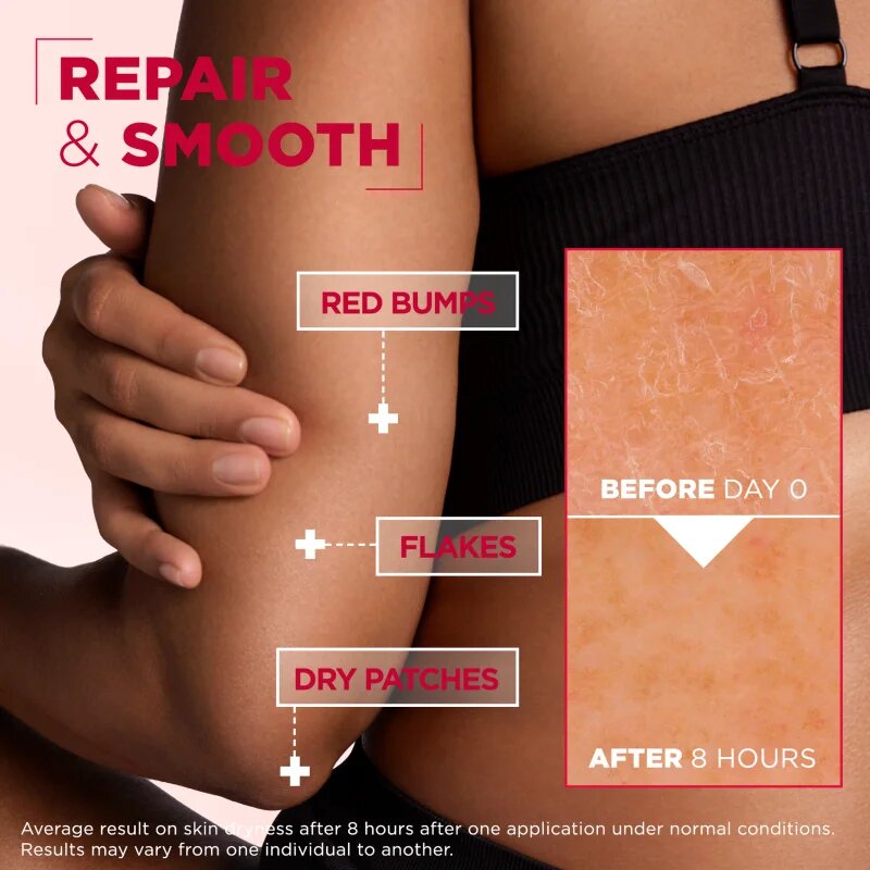 MIXA Urea Cica Repair+ regeneracijska krema za telo za zelo suho kožo 150 ml
