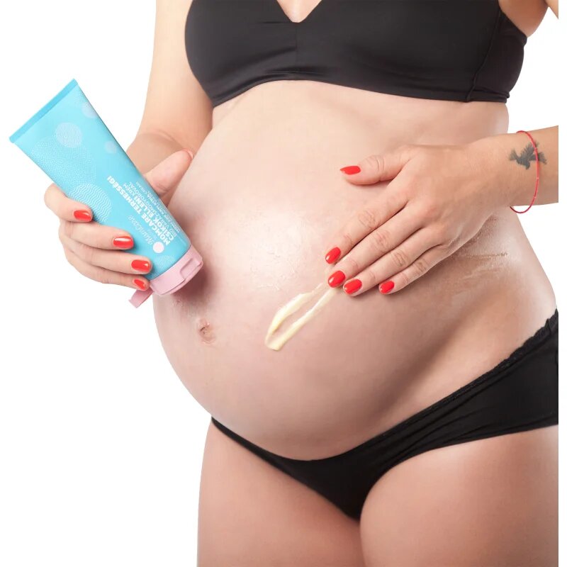 MomCare by Lina Anti-Stretch Mark Cream krema za telo proti strijam 200 ml