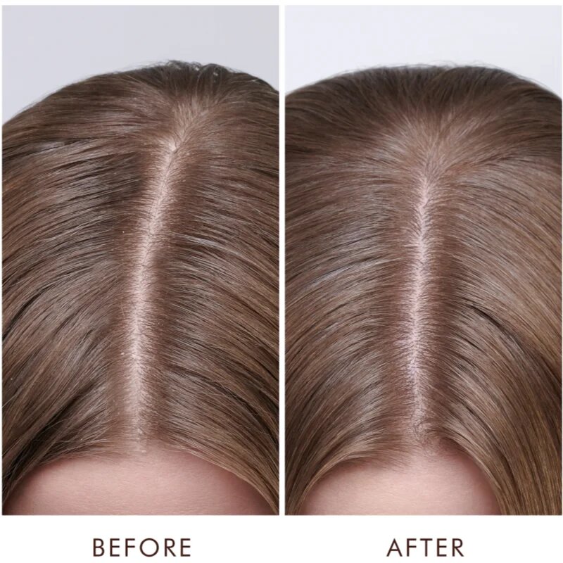 Moroccanoil Scalp Dry Scalp Treatment globinsko hranilna kura za suho kožo 45 ml