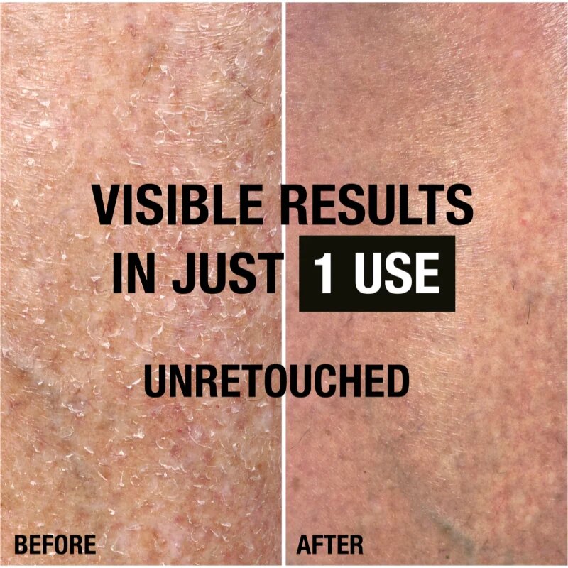 Neutrogena Norwegian Formula® Intense Repair darilni set za takojšnjo regeneracijo