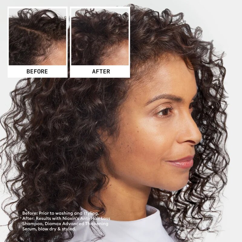 Nioxin Anti-Hair Loss Shampoo šampon proti izpadanju las 475 ml