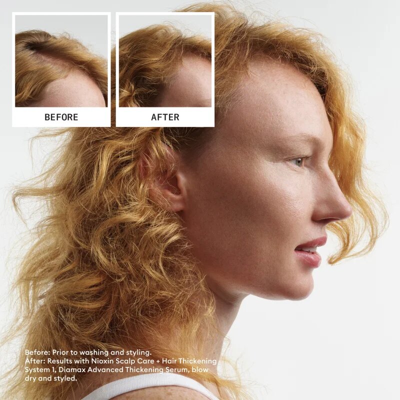 Nioxin System 1 darilni set za tanke ali redke lase 3 kos