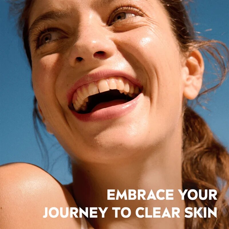 Nivea Derma Skin Clear obnovitveni serum za obraz za problematično kožo 30 ml