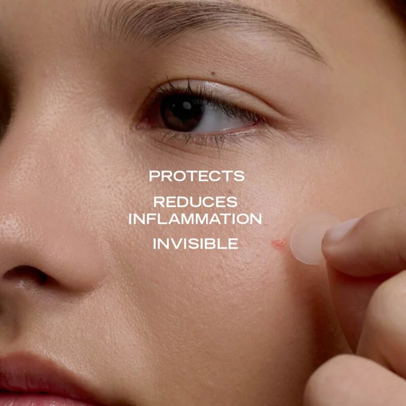 Payot Pâte Grise Stop Pimple Patch obliži za problematično kožo 36 kos