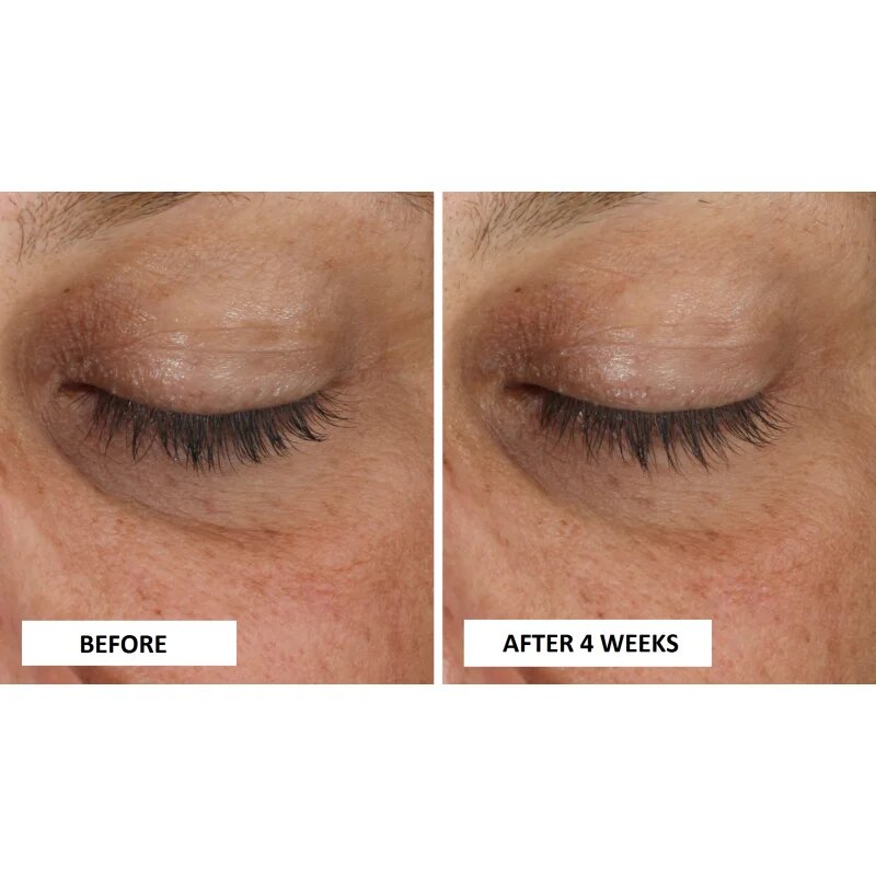 Perricone MD Cold Plasma Plus+ Eye Cream hranilna krema za predel okoli oči proti oteklinam in temnim kolobarjem 15 ml
