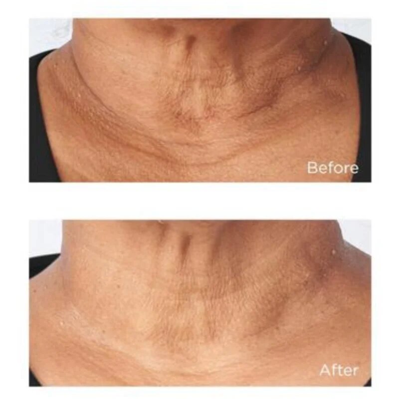 Perricone MD Cold Plasma Plus+ Sub-D/Neck učvrstitvena krema za vrat in dekolte 59 ml