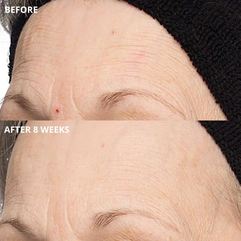 Perricone MD Cold Plasma Plus+ The Intensive Hydrating Complex intenzivna vlažilna krema 30 ml