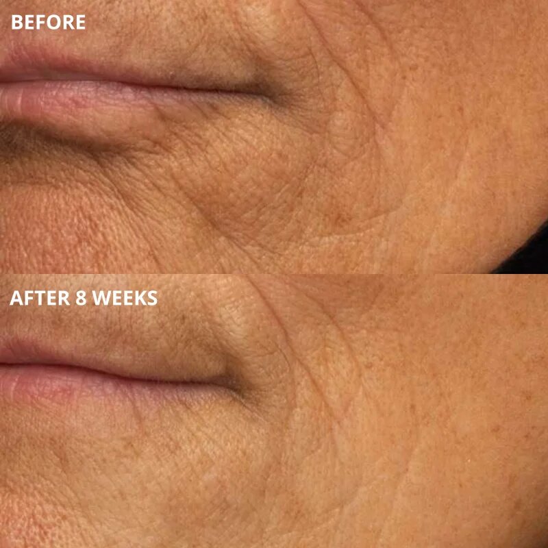 Perricone MD Cold Plasma Plus+ The Intensive Hydrating Complex intenzivna vlažilna krema 30 ml