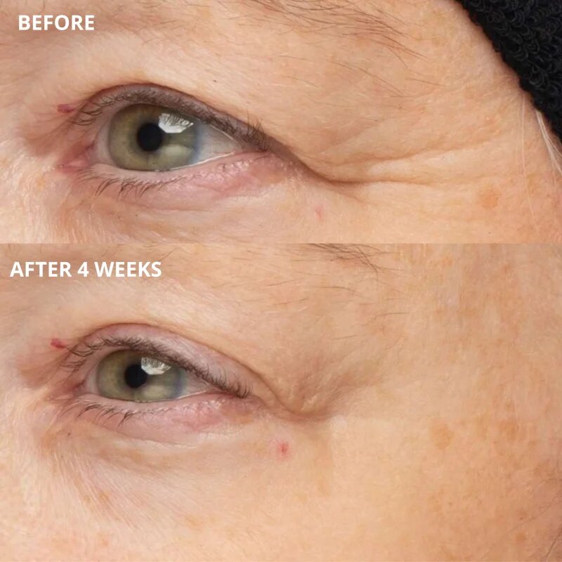 Perricone MD Cold Plasma Plus+ The Intensive Hydrating Complex intenzivna vlažilna krema 30 ml