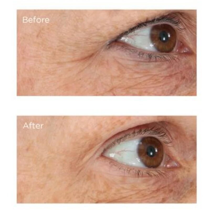 Perricone MD Essential Fx Acyl-Glutathione Eyelid Lift Serum lifting serum za predel okoli oči 15 ml