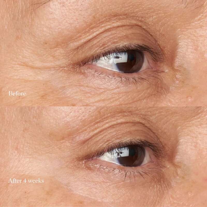 Perricone MD Hypoallergenic Clean Correction Eye Cream vlažilna in posvetlitvena nega za veke in kolobarje pod očmi 15 ml