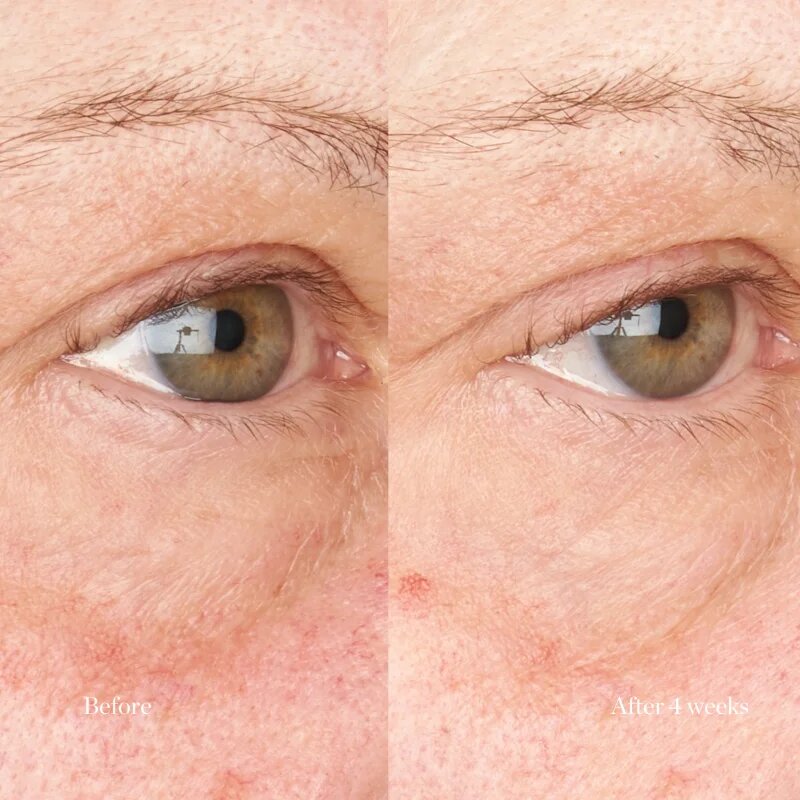 Perricone MD Hypoallergenic Clean Correction Eye Cream vlažilna in posvetlitvena nega za veke in kolobarje pod očmi 15 ml