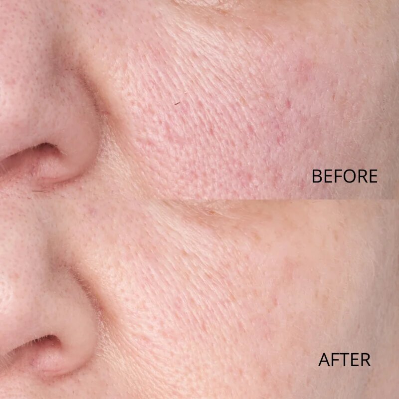 Perricone MD Hypoallergenic Clean Correction Smoothing Restorative Serum gladilni serum za hidracijo in posvetlitev kože 59 ml