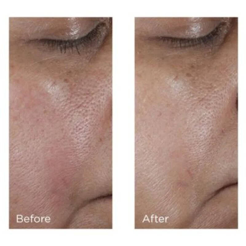 Perricone MD No:Rinse Pore Minimizing Toner intenzivni tonik za glajenje kože in zmanjšanje por 118 ml