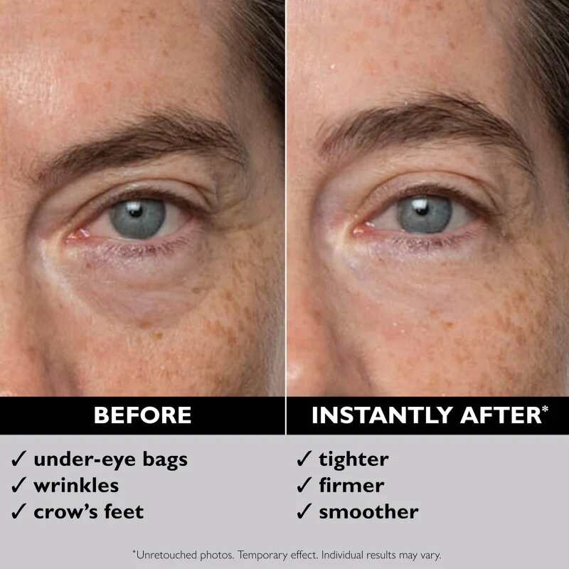 Peter Thomas Roth FIRMx® Eye Duo Set darilni set proti gubam okoli oči
