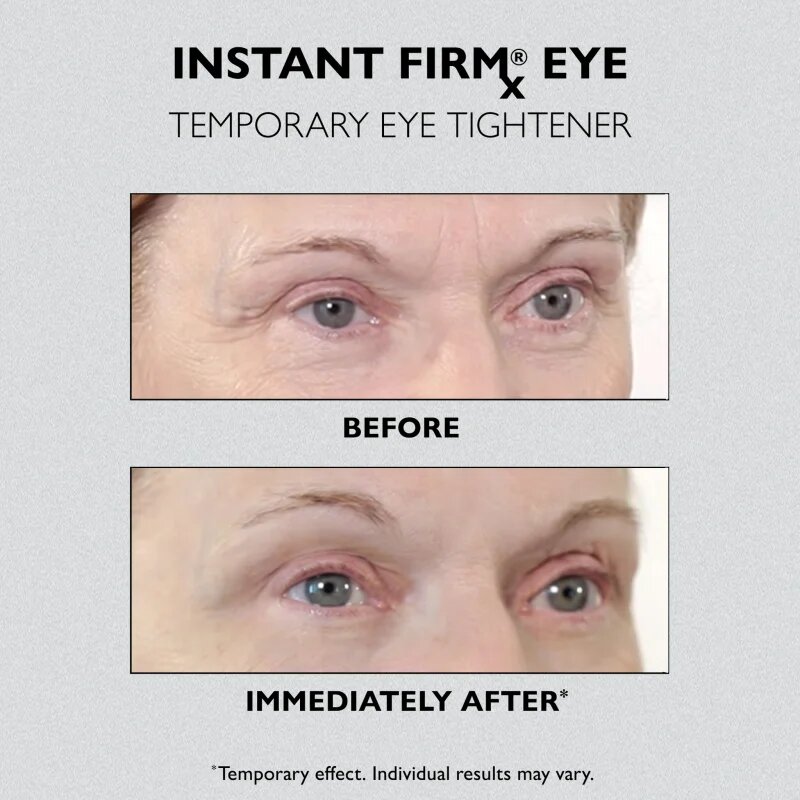 Peter Thomas Roth Instant FIRMx Eye krema za predel okoli oči za pomladitev kože 30 ml