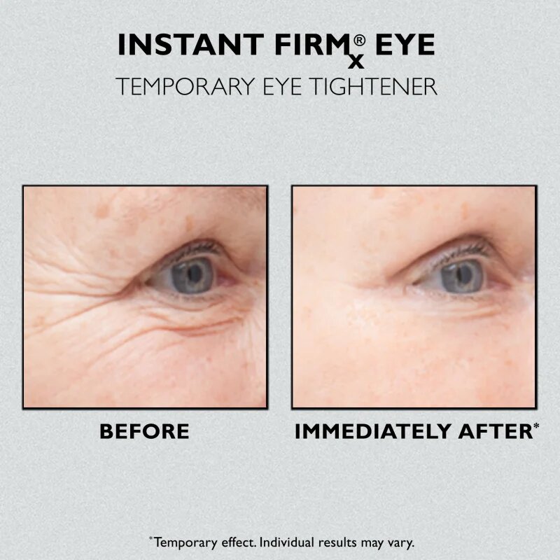 Peter Thomas Roth Instant FIRMx Eye krema za predel okoli oči za pomladitev kože 30 ml
