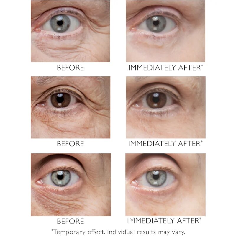 Peter Thomas Roth Instant FIRMx Eye krema za predel okoli oči za pomladitev kože 30 ml