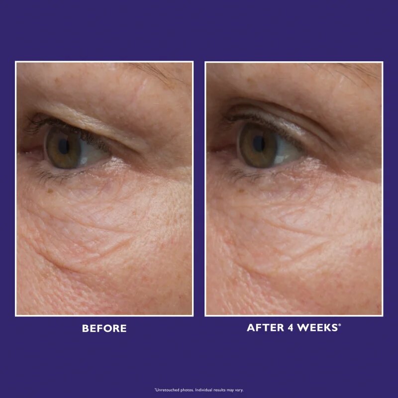 Peter Thomas Roth Ultimate Solution 5 Multitasking Eye Cream bogata vlažilna krema za oči 15 ml